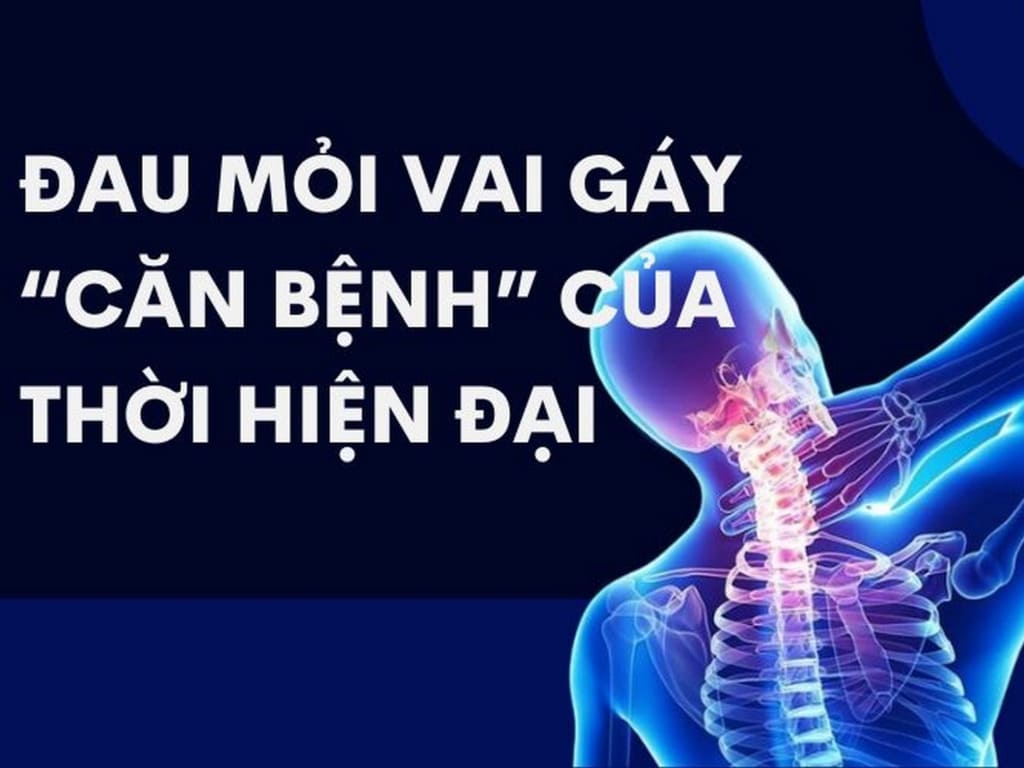 NGUYÊN NHÂN, TRIỆU CHỨNG , CHUẨN ĐOÁN ĐIỀU TRỊ ĐAU CỔ VAI GÁY