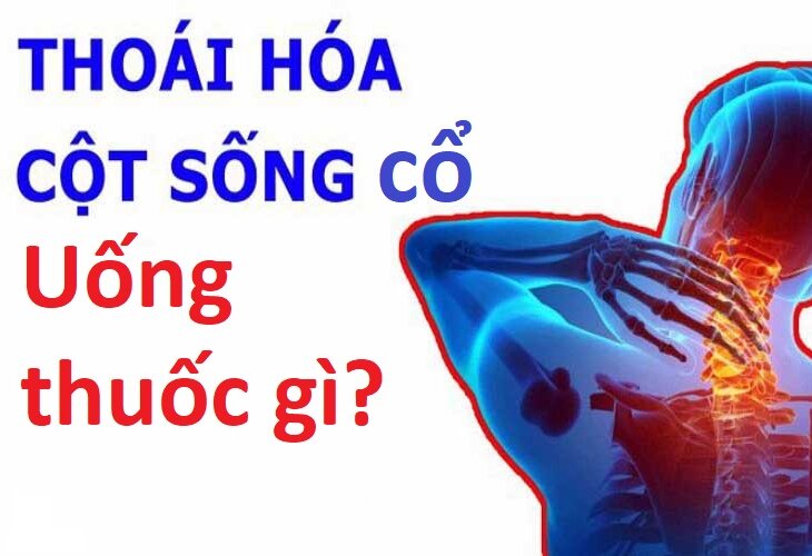 THOÁI HÓA ĐỐT SỐNG CỔ UỐNG THUỐC GÌ