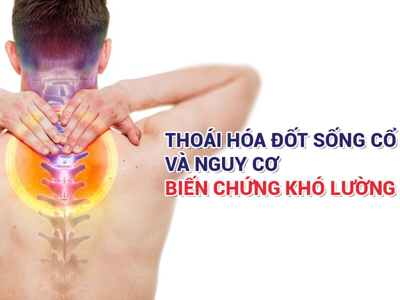 Các biến chứng nguy hiểm của bệnh thoái hóa cột sống lưng và cột sống cổ