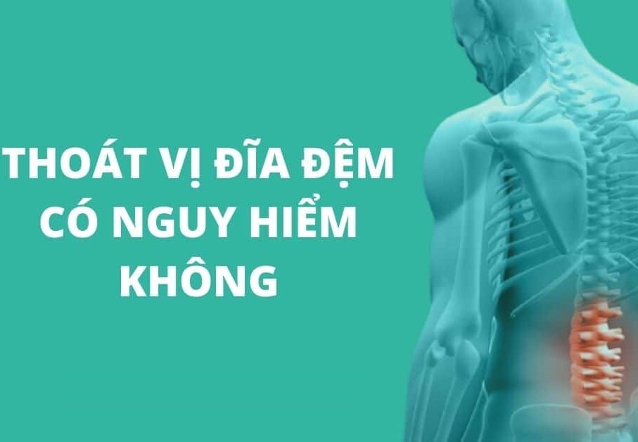 THOÁT VỊ ĐĨA ĐỆM CÓ NGUY HIỂM KO