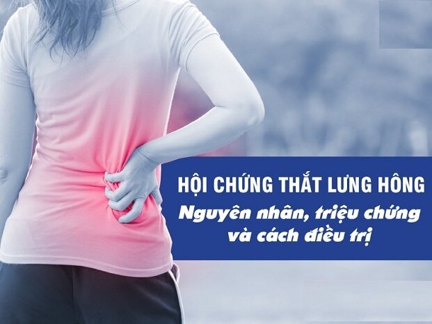 Hội chứng thắt lưng hông: Nguyên nhân, triệu chứng và cách điều trị