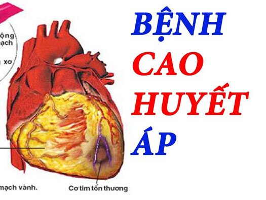 Cao huyết áp là bệnh gì? Có nguy hiểm không?