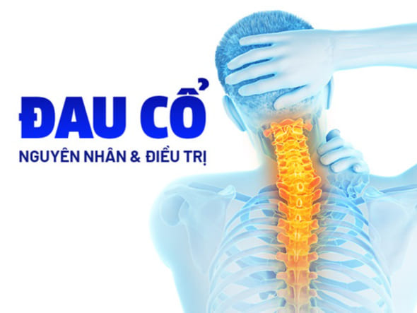 Biện pháp khắc phục chứng cứng cổ