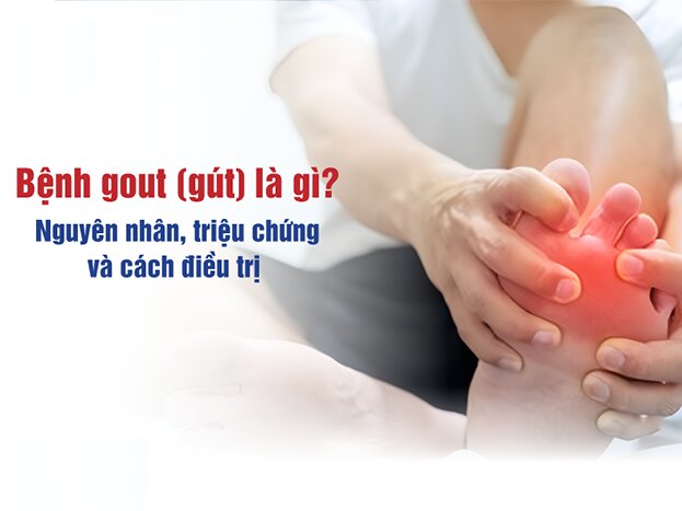 Bệnh gout (gút) là gì? Nguyên nhân, triệu chứng và cách điều trị