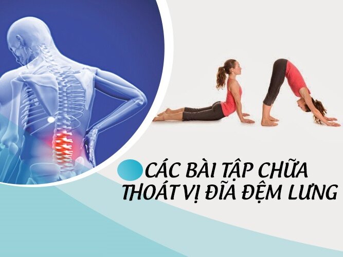 Cách dân gian chữa thoát vị đĩa đệm tại nhà