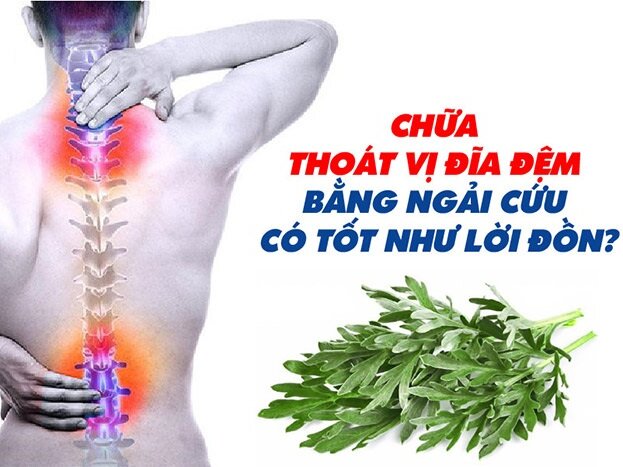 Bài Thuốc Dân Gian Chữa Thoát Vị Đĩa Đệm Hay Nhất