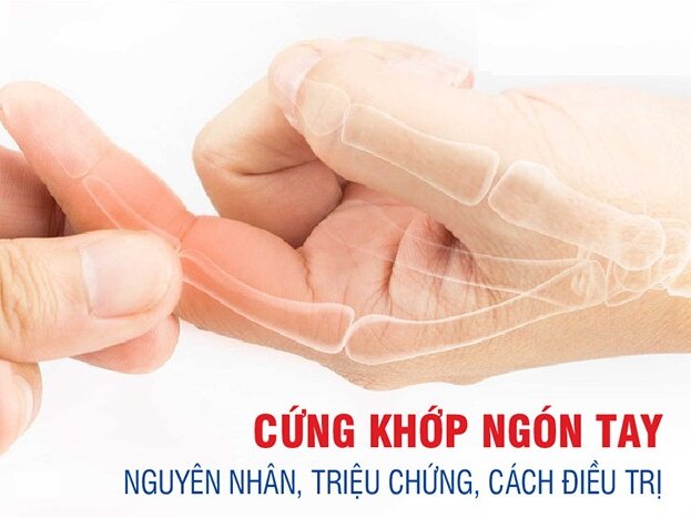 Cứng khớp ngón tay: Nguyên nhân, triệu chứng, cách điều trị