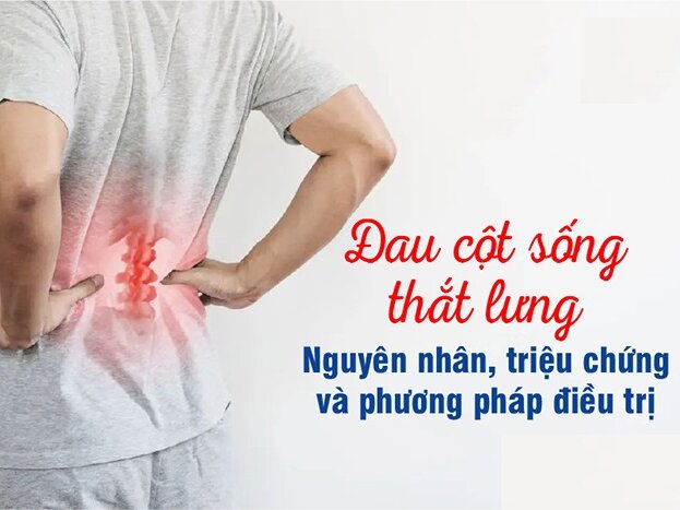 Đau cột sống lưng là gì? Cách điều trị đau cột sống lưng