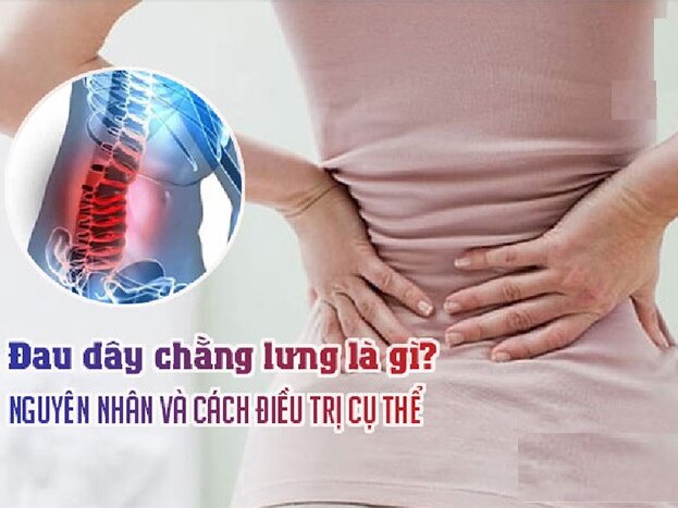 Đau dây chằng lưng là gì? Nguyên nhân, cách điều trị và phòng tránh