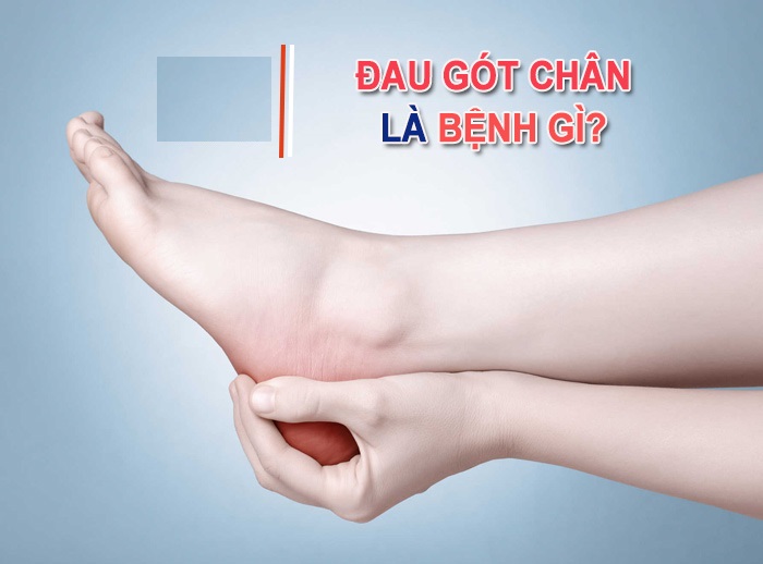 Đau gót chân là bệnh gì? Nguyên nhân và cách điều trị