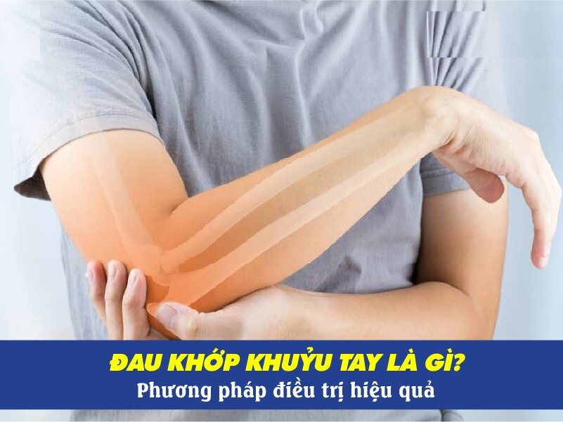 Đau khớp khuỷu tay có nguy hiểm không? Cách điều trị hiệu quả