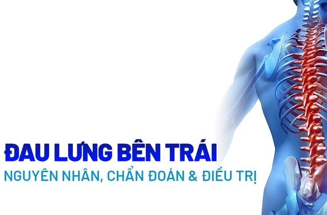 Đau thắt lưng bên trái là bệnh gì? Nguyên nhân, cách điều trị