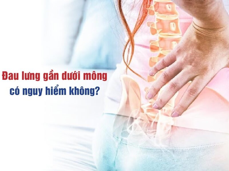 Đau lưng gần dưới mông có nguy hiểm không? Nguyên nhân do đâu?