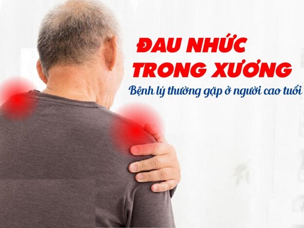 Cảm giác đau nhức trong xương là chứng bệnh gì? Tham khảo ngay!