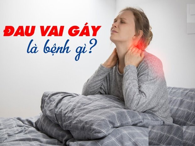 Đau mỏi cổ vai gáy: Nguyên nhân, triệu chứng và cách điều trị