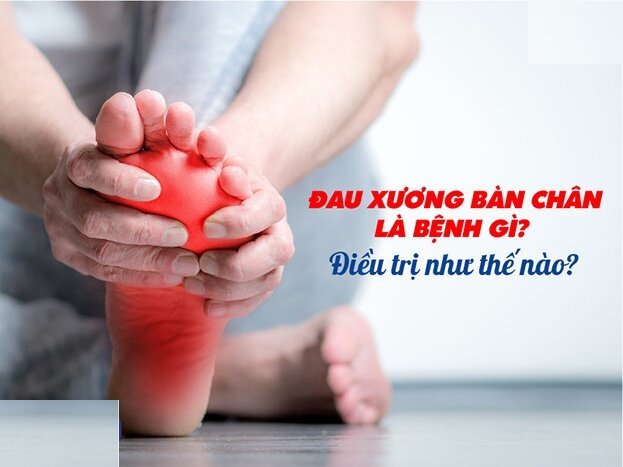 Đau xương bàn chân là bệnh gì? Điều trị như thế nào?