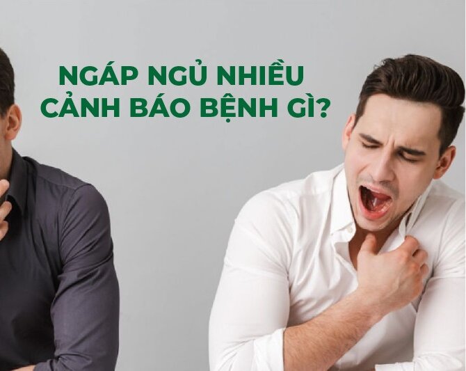 Ngáp ngủ nhiều là bệnh gì? Khi nào cần đi khám bác sĩ?