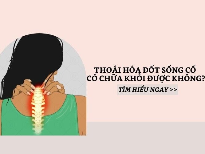 Thoái hóa đốt sống cổ có chữa được không?