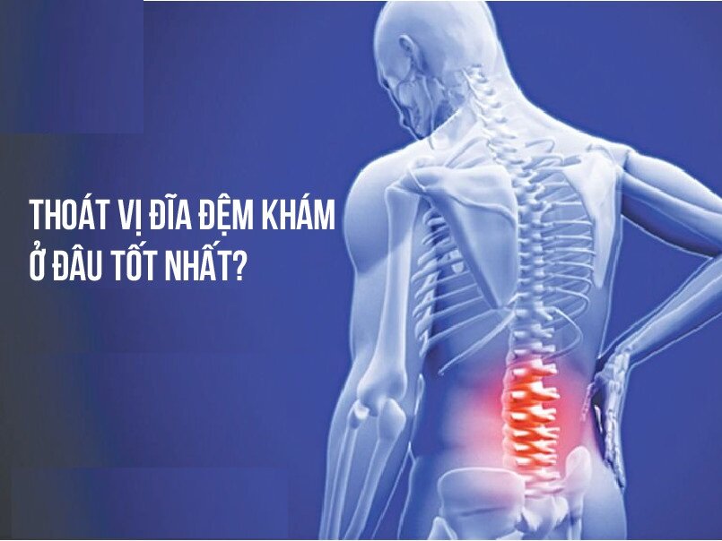 THOÁT VỊ ĐĨA ĐỆM CHỮA Ở ĐÂU?