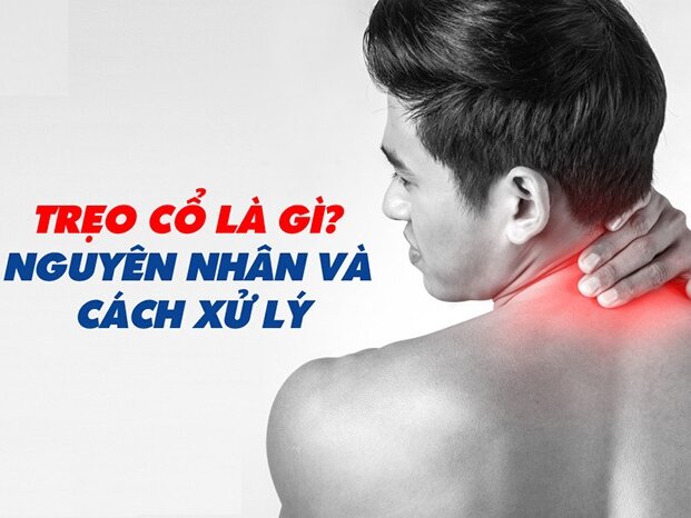 Trẹo cổ là gì? Nguyên nhân và cách xử lý