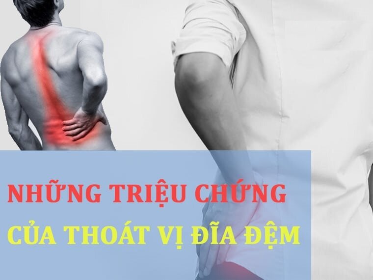 NHỮNG BIỂU HIỆN CỦA THOÁT VỊ ĐĨA ĐỆM