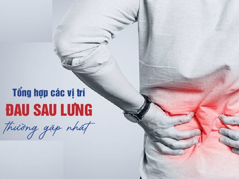 Các vị trí đau sau lưng thường gặp – Đau ở đâu nguy hiểm nhất?