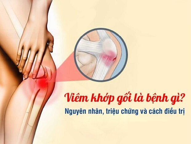 Bệnh viêm khớp gối là gì? Nguyên nhân, cách điều trị