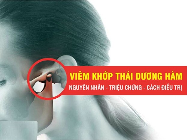 VIÊM KHỚP THÁI DƯƠNG HÀM: NGUYÊN NHÂN - TRIỆU CHỨNG VÀ ĐIỀU TRỊ