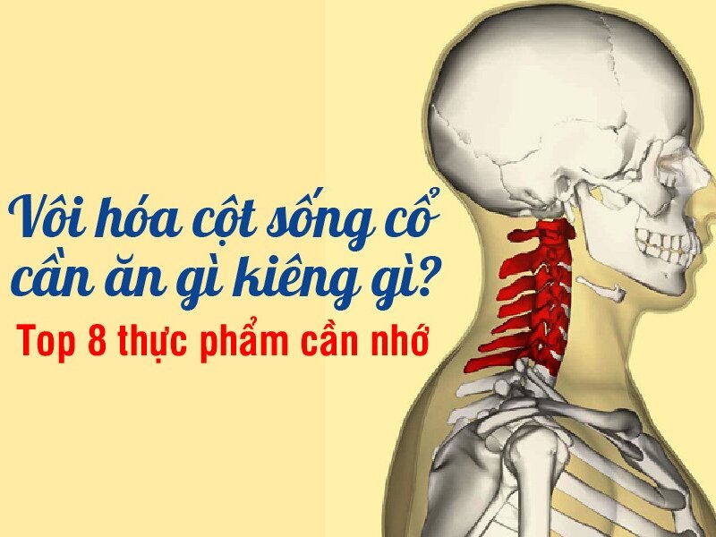 Chữa vôi hóa cột sống cổ cần ăn gì, kiêng gì?