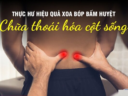 Cách Xoa Bóp Giảm Đau Cho Bệnh Nhân Thoái Hóa Đốt Sống Cổ